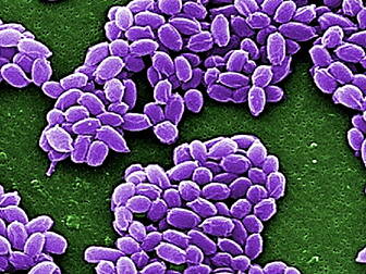 US military reviews anthrax pr...